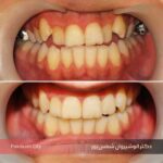 نمونه کار یک ارتودنسی دندان دکتر شمس پور